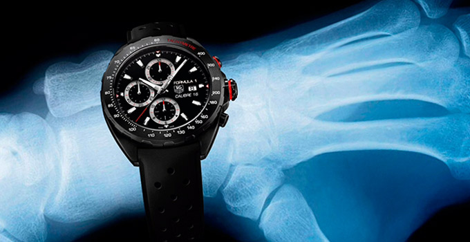 relojes-2014-15