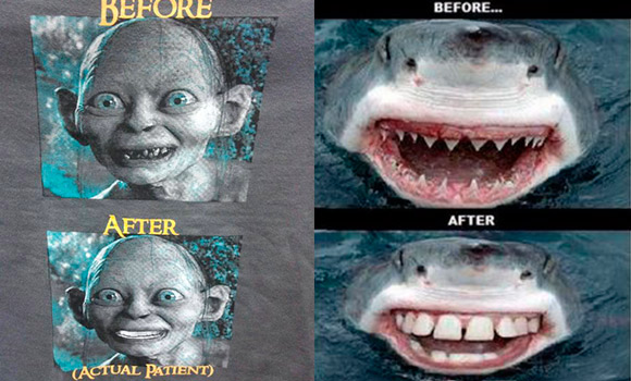 golum-tiburon